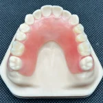 Flexible-Denture